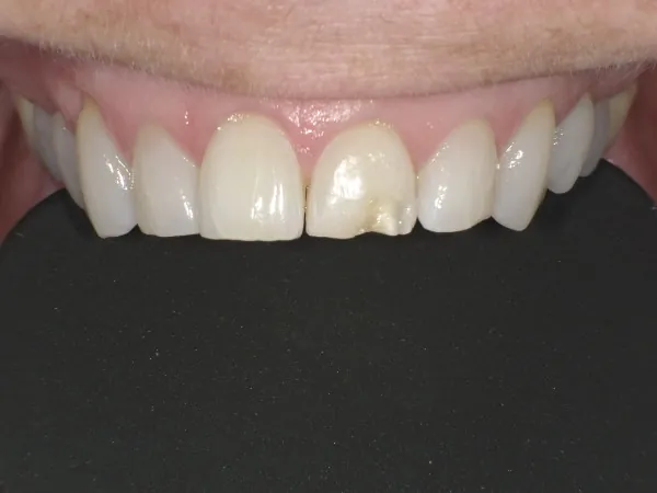 Before image
