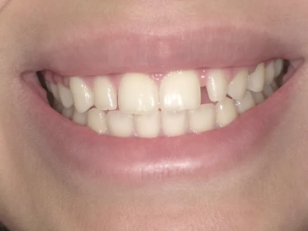 Before image
