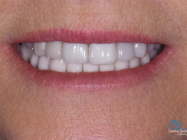 Before image