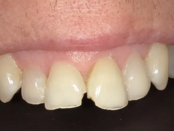 Before image