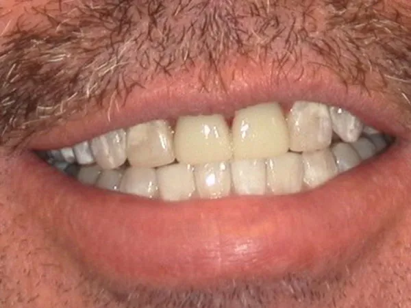 After image