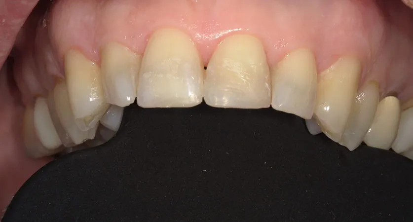 After image