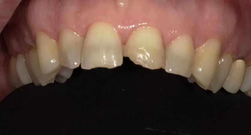 Before image