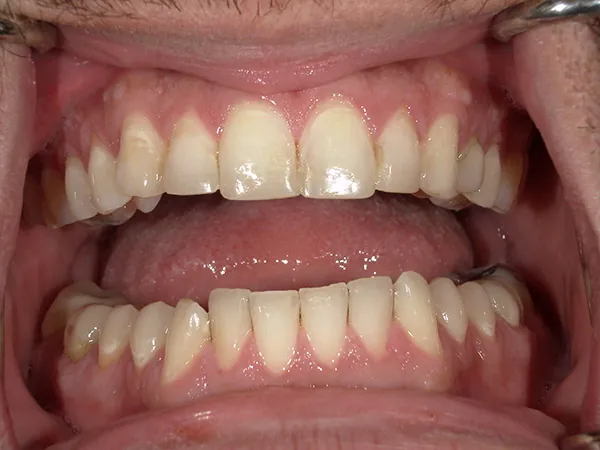After image