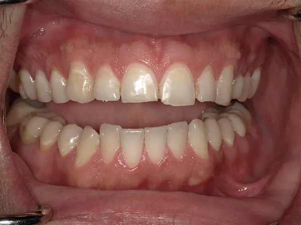 Before image