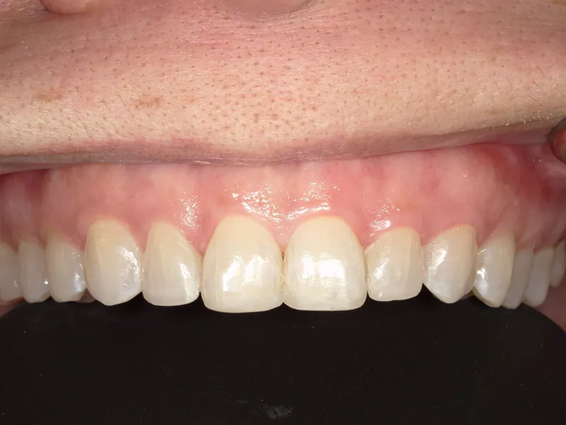After image