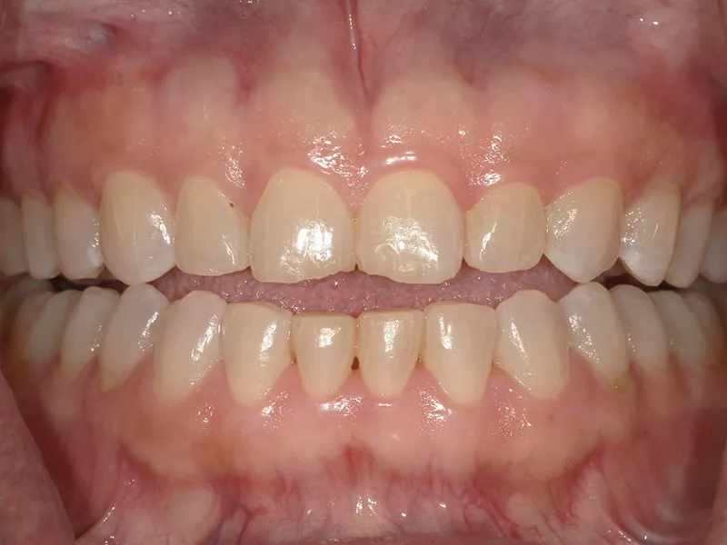 Before image