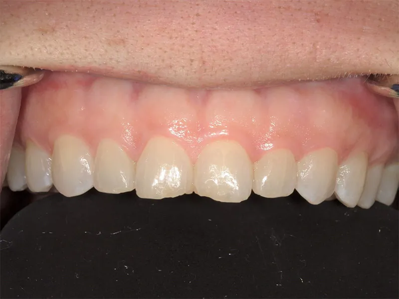 Before image
