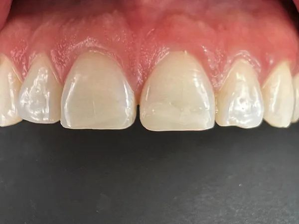 After image