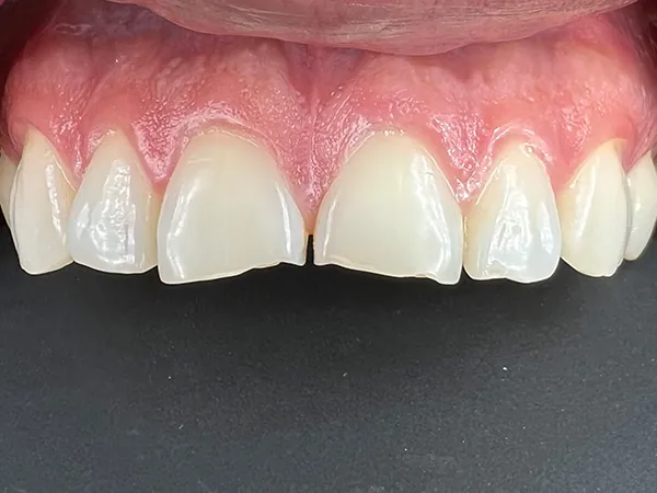 Before image