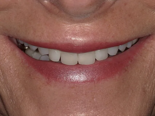 After image