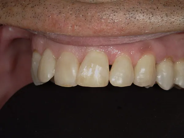 After image