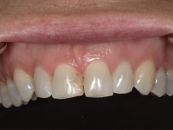 Before image