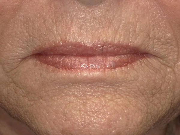 Before image