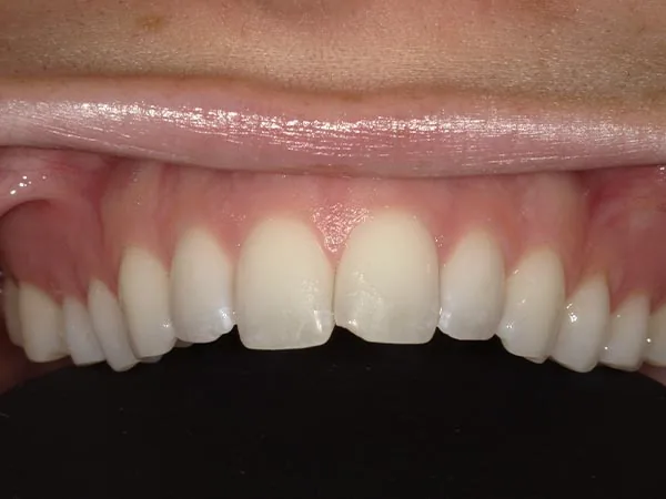 Before image